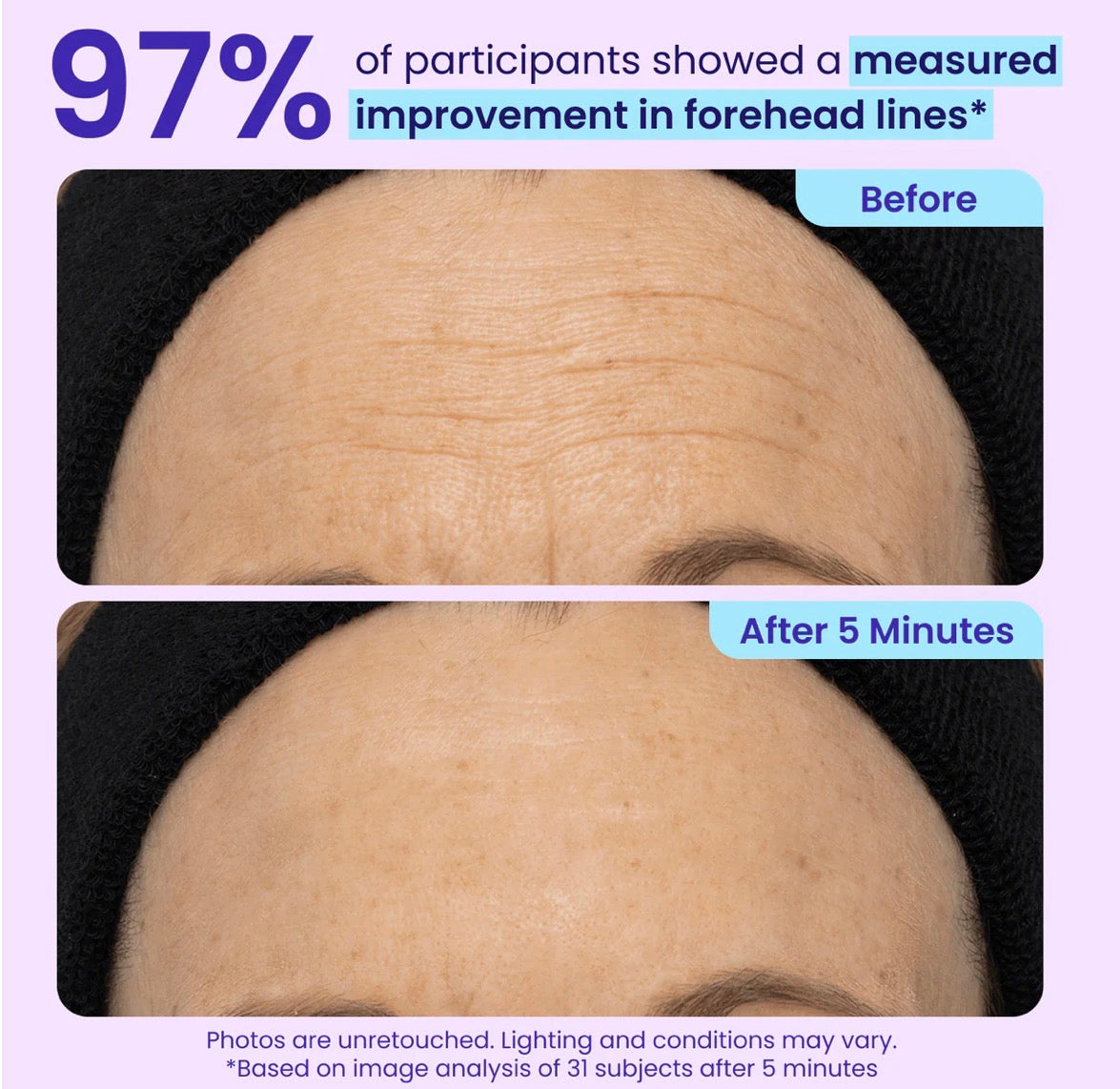 Instant Lift Eye Gel