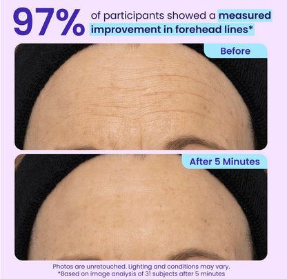Instant Lift Eye Gel